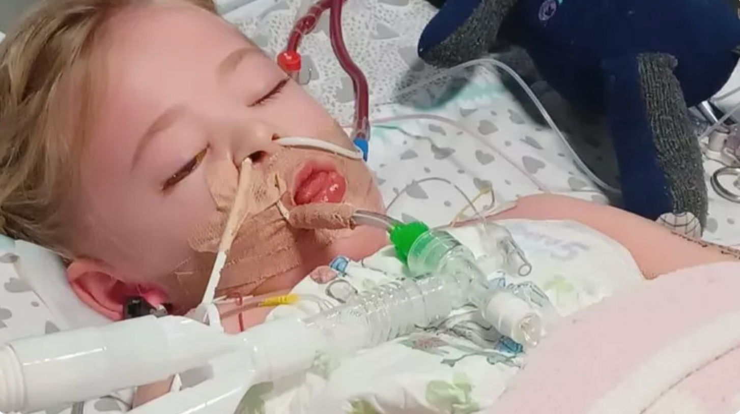 Camila Rose Burns was on a ventilator as she fought a Strep A infection