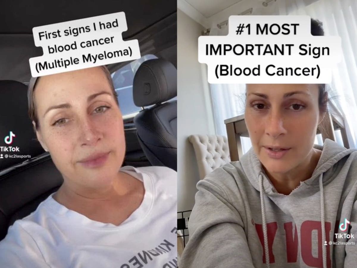 Woman&rsquo;s blood cancer misdiagnosed as carpal tunnel due to burning hand pain