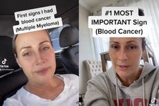 Woman’s blood cancer misdiagnosed as carpal tunnel due to burning hand pain