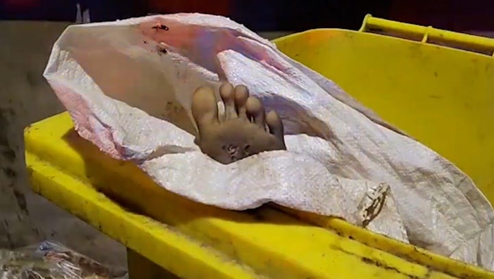 Police realise dismembered dead body in bin isn t what it looks