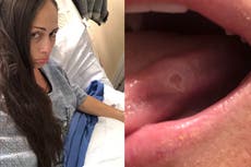 Woman’s blood cancer misdiagnosed as carpal tunnel due to burning hand pain