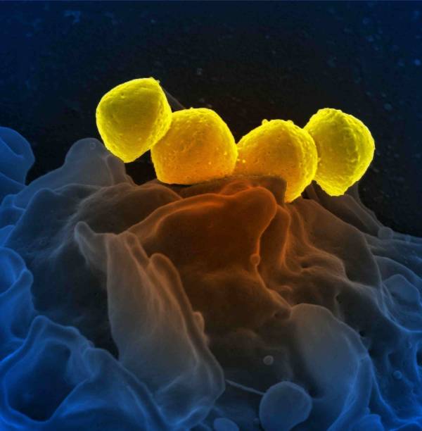 Scanning electron micrograph of Group A Streptococcus