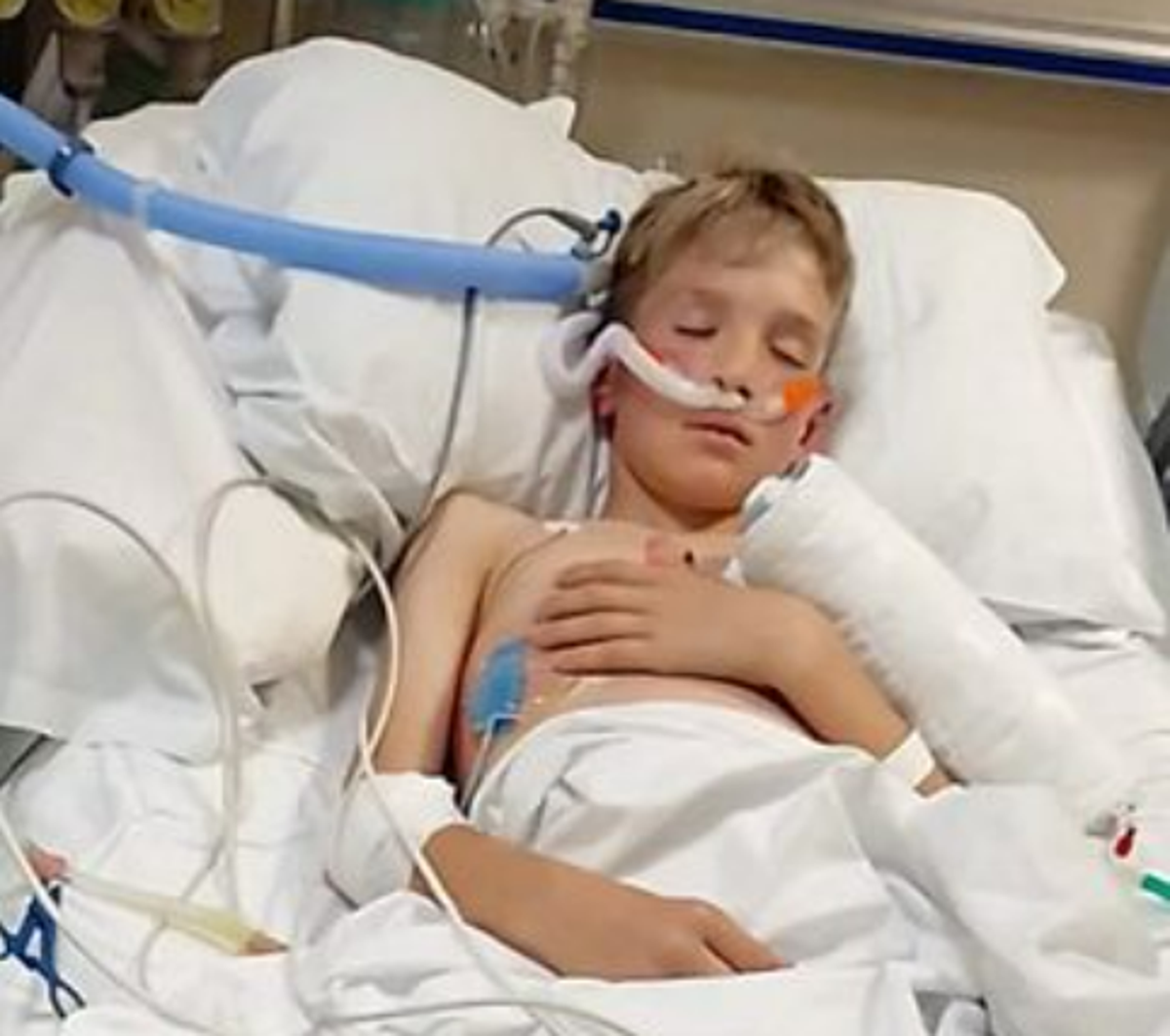 Strep A infection: Sunny Gosling fighting for his life after doctors misdiagnosed him with Covid and ‘pulled muscle’