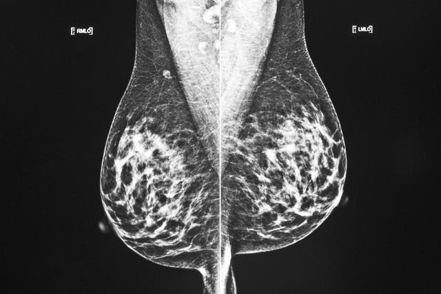 <p>A picture from a mammogram screening </p>