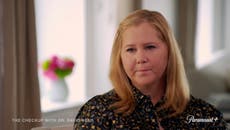 ‘It’s a lonely disease’: Amy Schumer opens up about endometriosis struggle