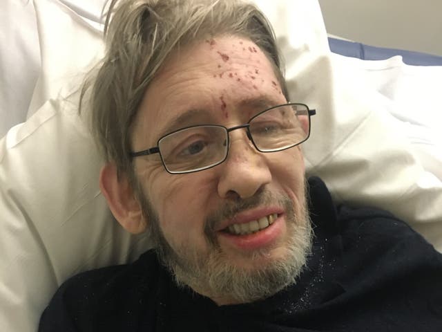 <p>Shane MacGowan pictured in hospital in a photo shared to social media by his wife</p>