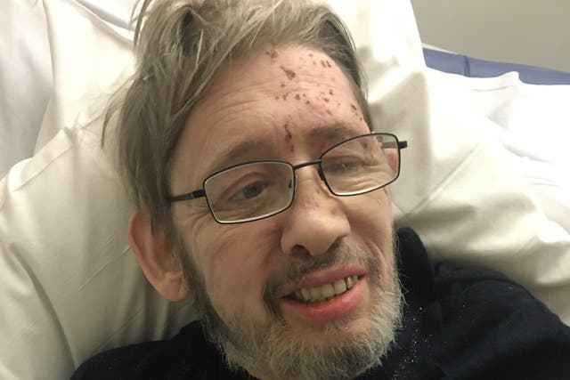 <p>Shane MacGowan pictured in hospital in a photo shared to social media by his wife</p>