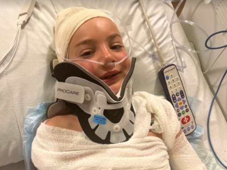 Stefan Keryan, 8, recovering from third-degree burns and a skull fracture he sustained during a horseback riding incident