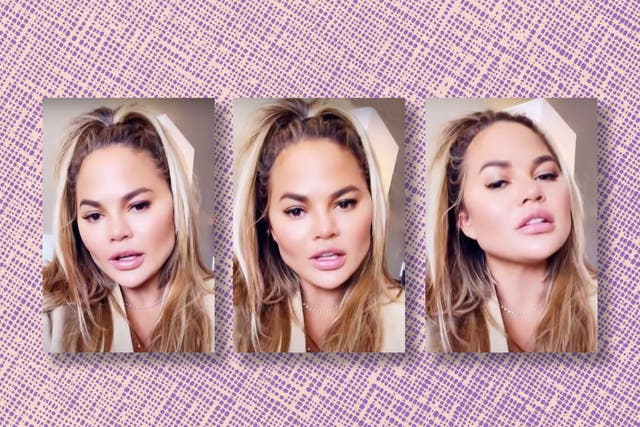 <p>‘I did that buccal fat removal thing’: Chrissy Teigen on Instagram in late 2021</p>