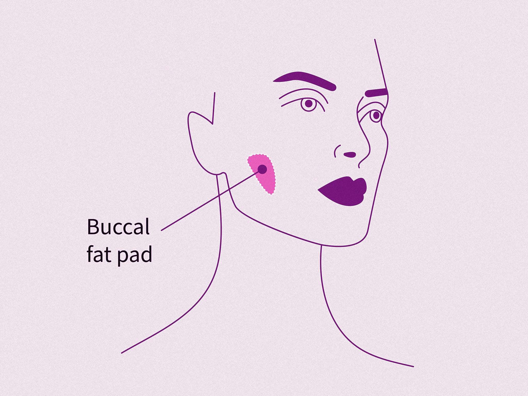 What is buccal fat removal and how it became the strangest and most  secretive beauty trend of 2022