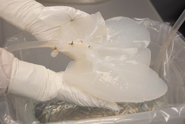 ÓRGANOS CREADOS POR BIOINGENIERÍA