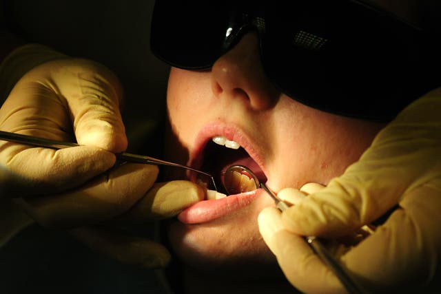 The state of children’s teeth is a “national disgrace”, a top children’s doctor has warned (PA)