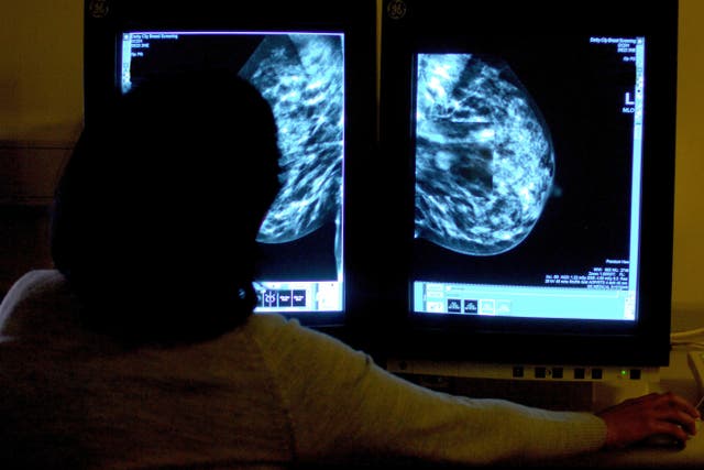 Scientists hope further research will help translate the study’s findings into targeted therapies for breast cancer patients (Rui Vieira/PA)