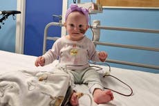 Baby’s brain tumour diagnosed after mother spots four warning signs
