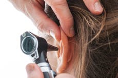 Take tests to ensure hearing loss diagnosed early, public urged