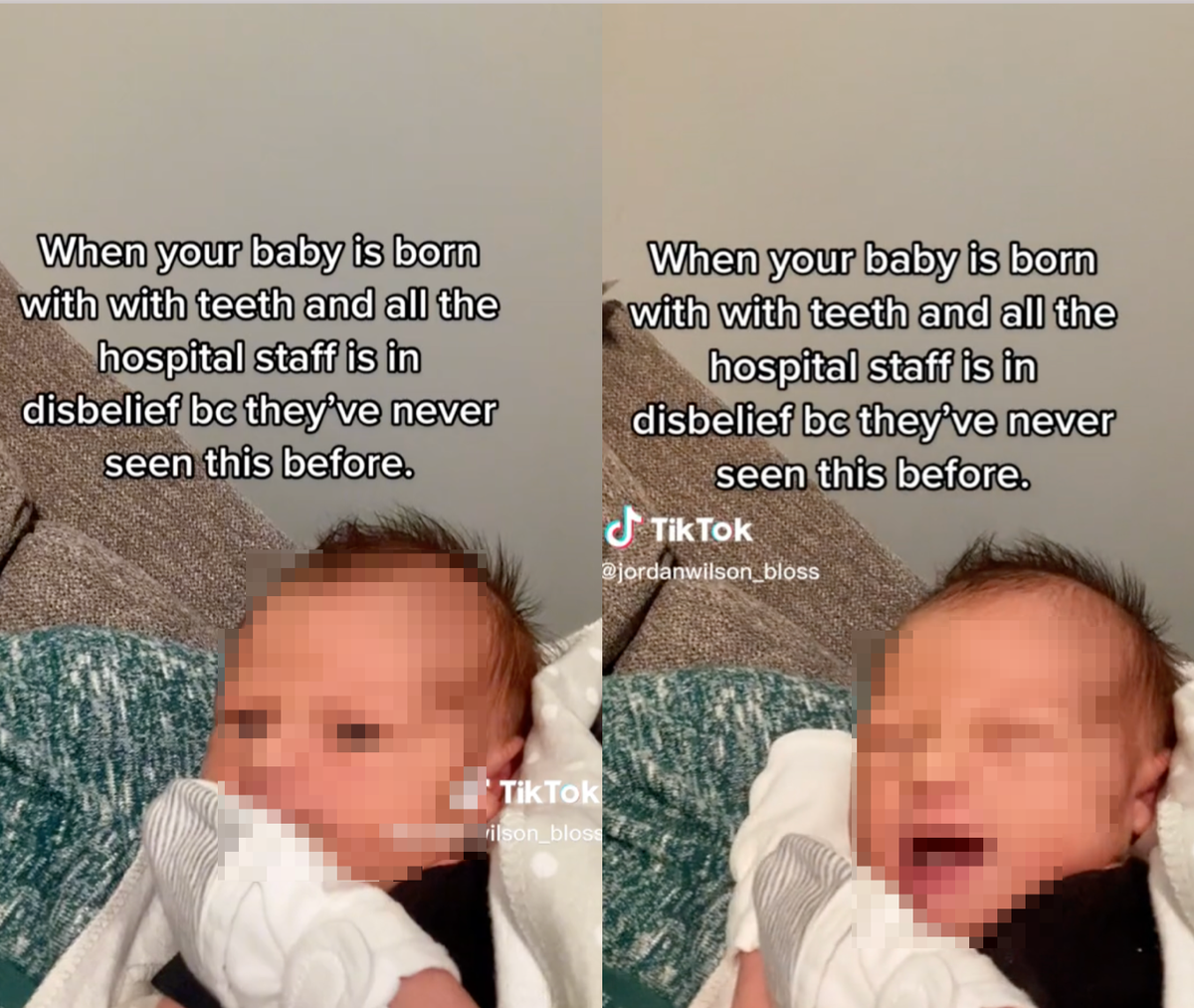 Mother says hospital staff was &lsquo;in disbelief&rsquo; when her baby was born with teeth
