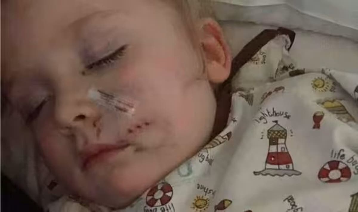Mother of toddler mauled by Staffordshire Bull Terrier &lsquo;feared daughter would die&rsquo;