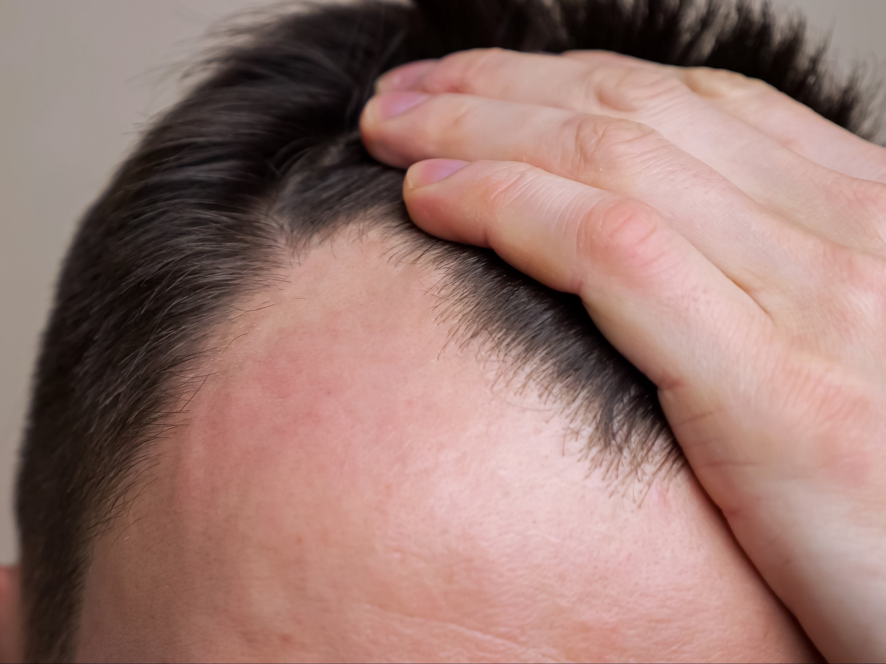 Help Prevent Hair Loss by Staying Hydrated  Hair Club