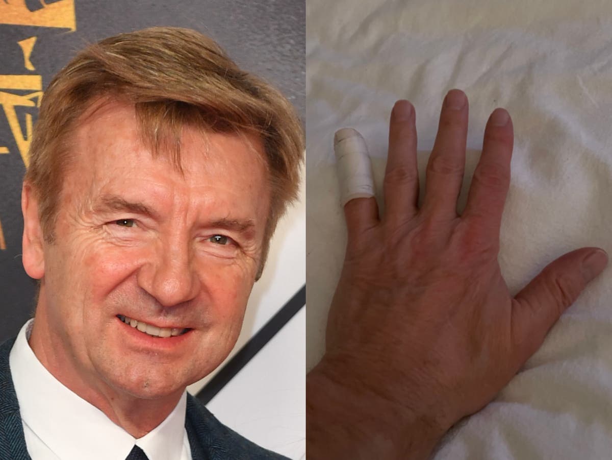 ‘Broken’: Dancing on Ice star Christopher Dean suffers sudden injury days before series begins ‘Broken’: Dancing on Ice star Christopher Dean suffers sudden injury days before series begins