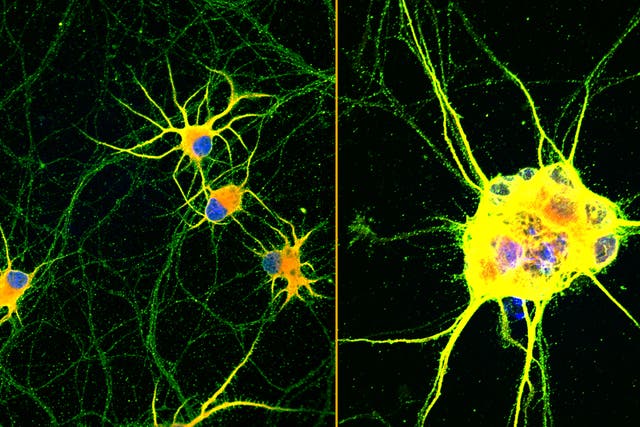 Fluorescent images of human neurons (Northwestern University)