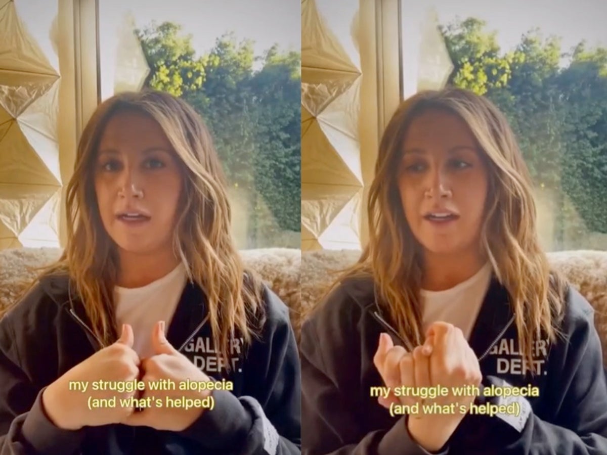 Ashley Tisdale opens up about alopecia struggle: ‘It’s nothing to be ashamed of’