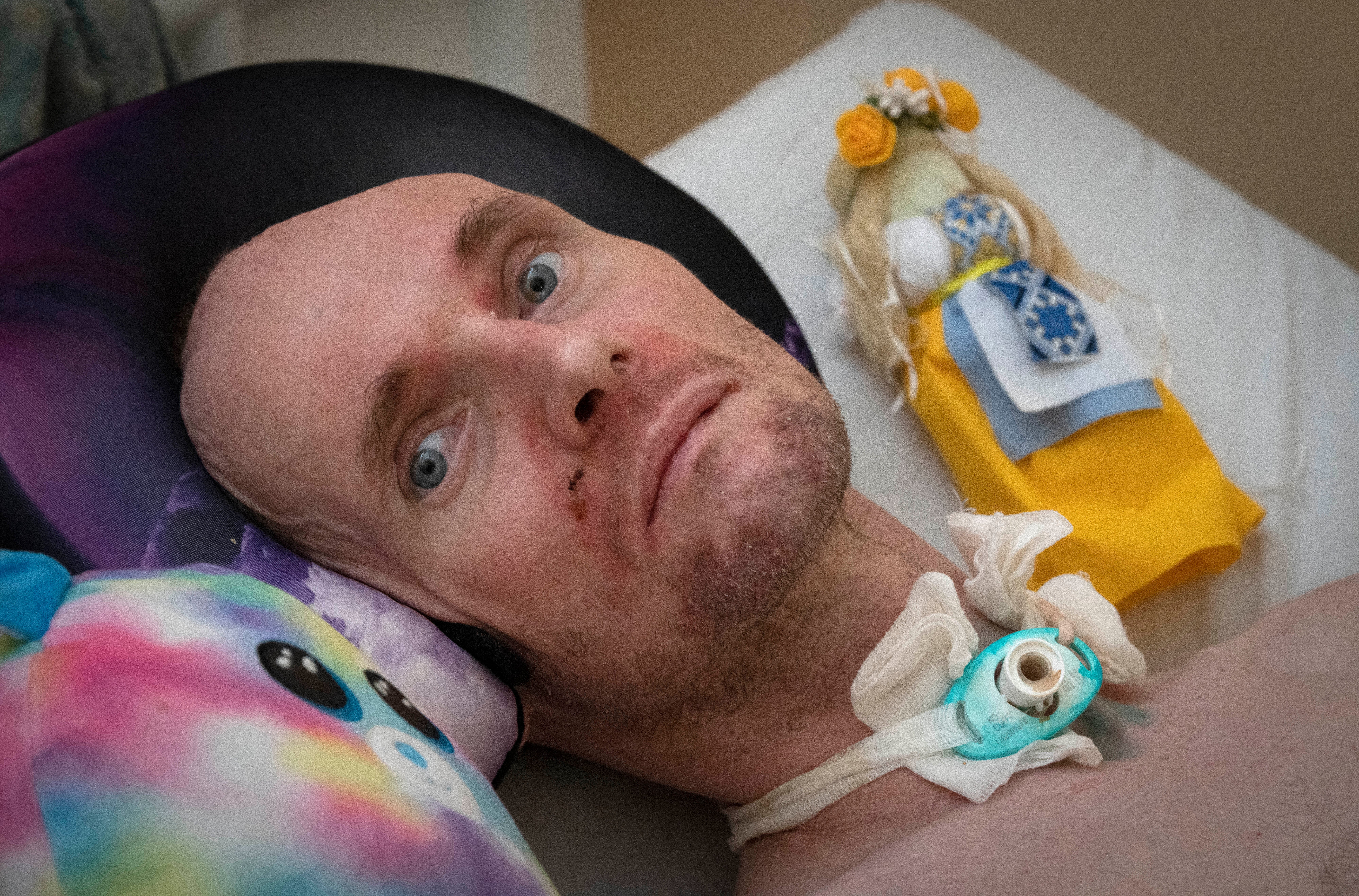 Russia Ukraine War Fighting's Toll