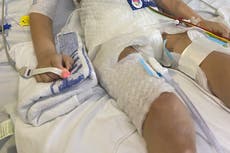 Boy diagnosed with brain tumour after doctors dismissed symptoms as stomach bug