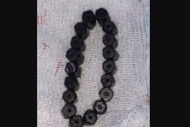<p>A four-year-old ingested multiple magnetic beads</p>