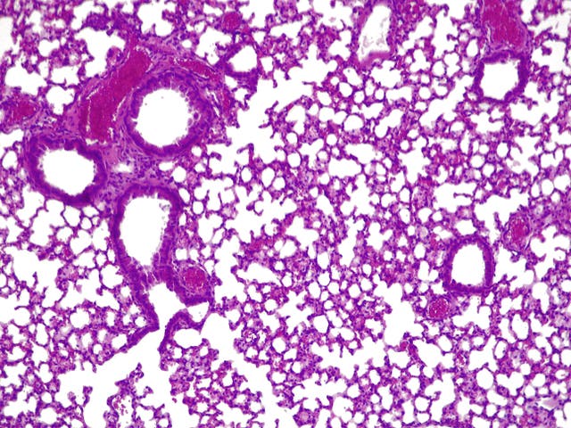 <p>a cross-section of a mouse lung infected with Pseudonomas aeruginosa</p>