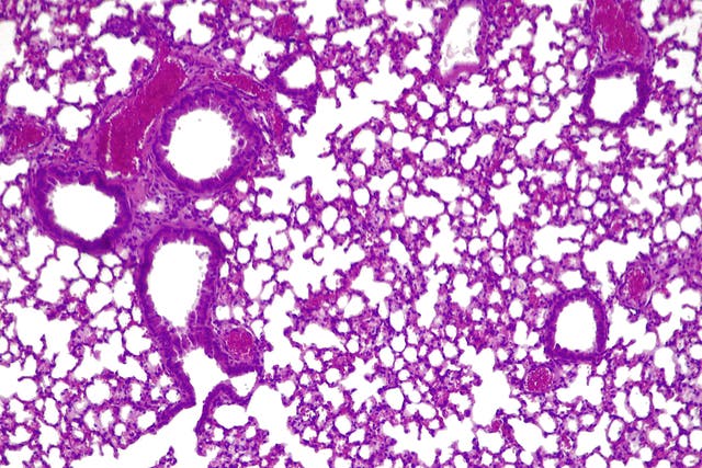 <p>a cross-section of a mouse lung infected with Pseudonomas aeruginosa</p>