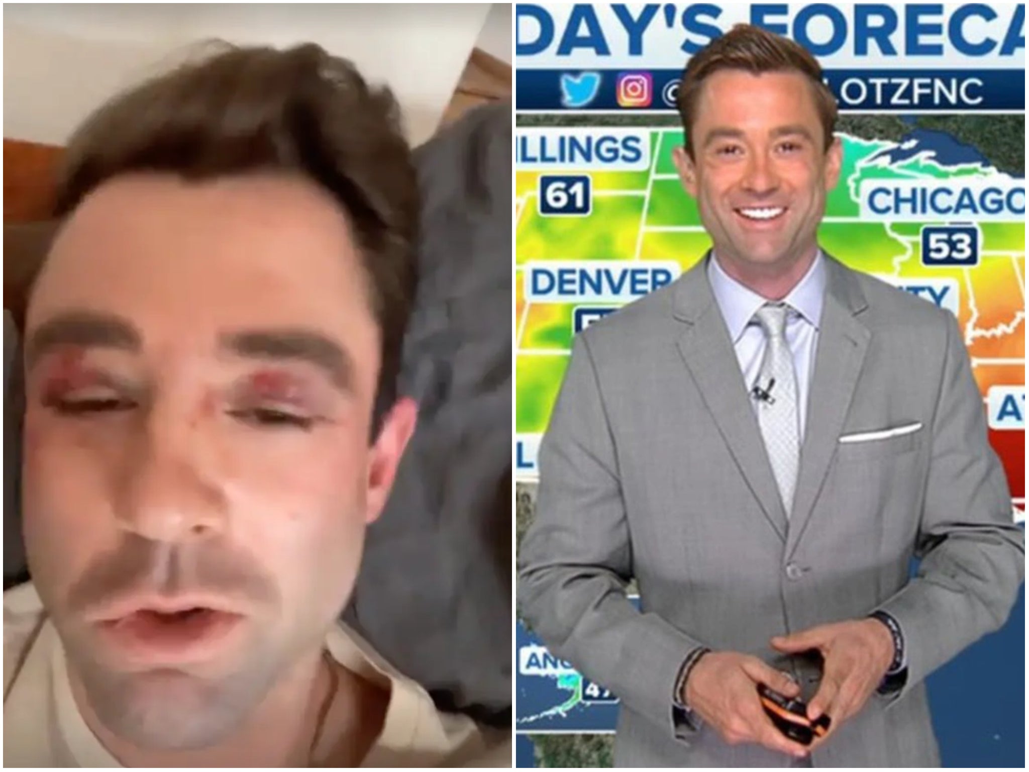 Fox News weatherman Adam Klotz, 37, said he was assaulted by a group of teenagers on the New York Subway