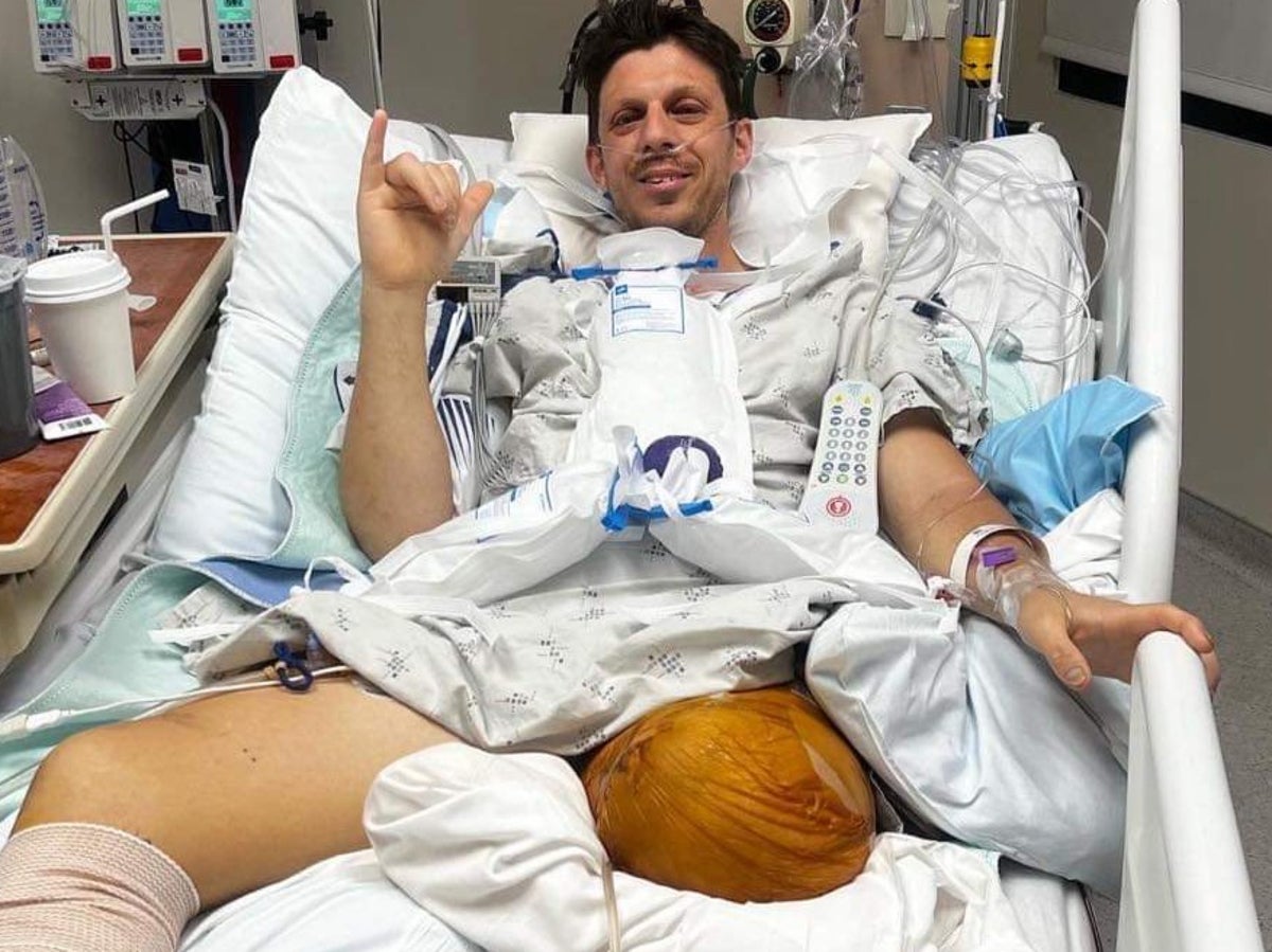 Father loses both legs after shielding family in horror snow blower accident