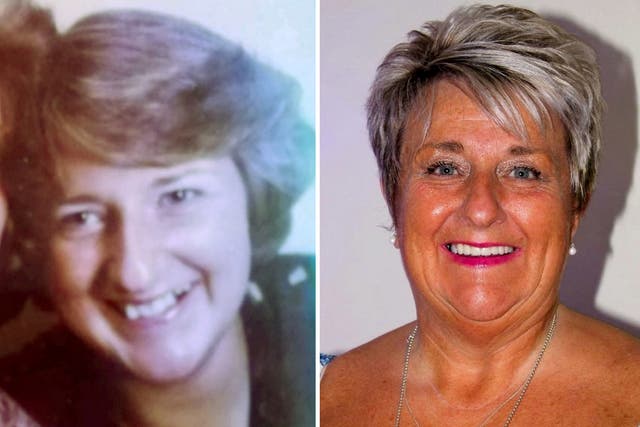 <p>Olive Bruce, smiling before (L) and after (R) having her teeth fixed</p>