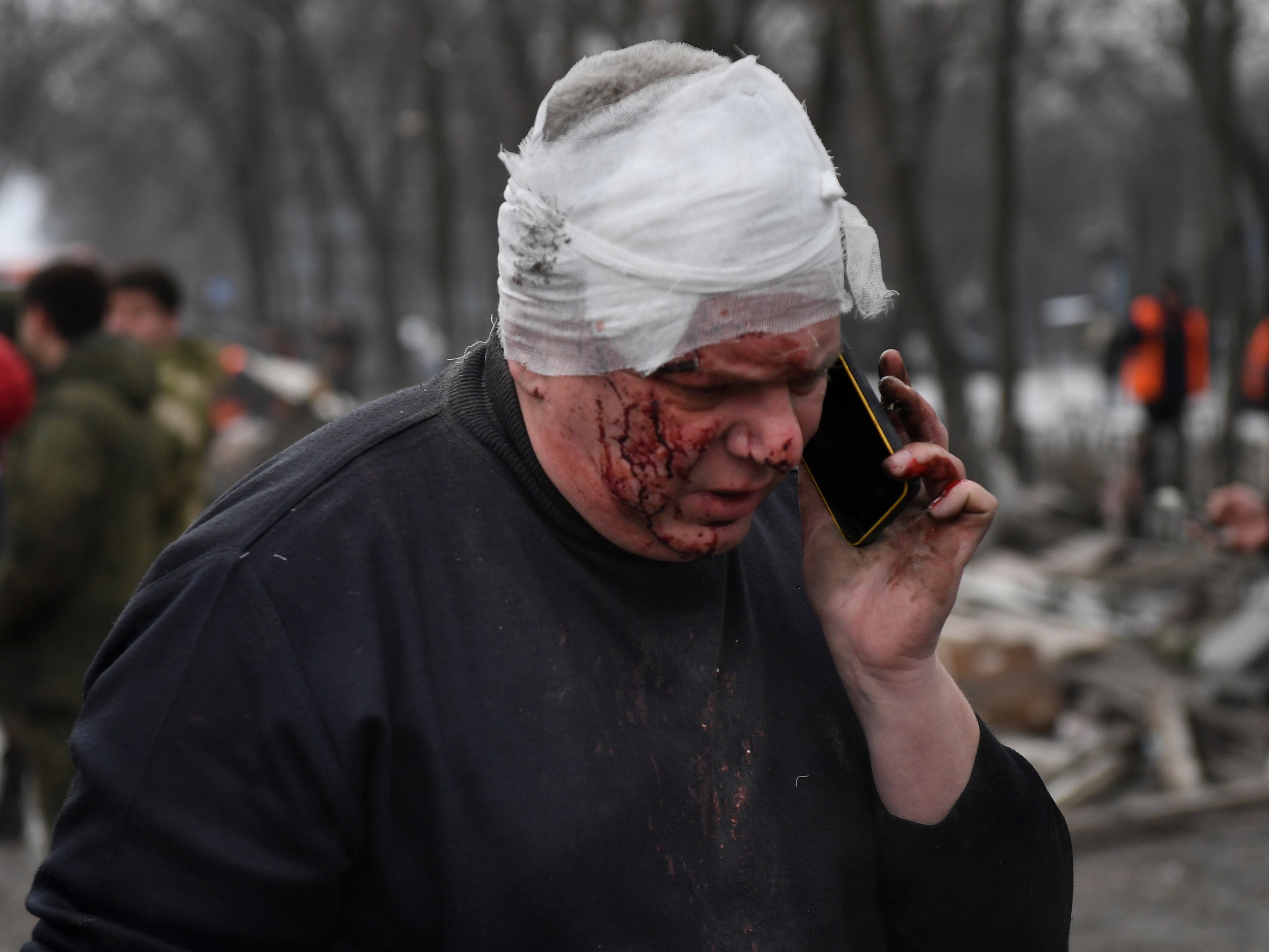 A wounded man on the phone in Donetsk after a shopping centre was destroyed