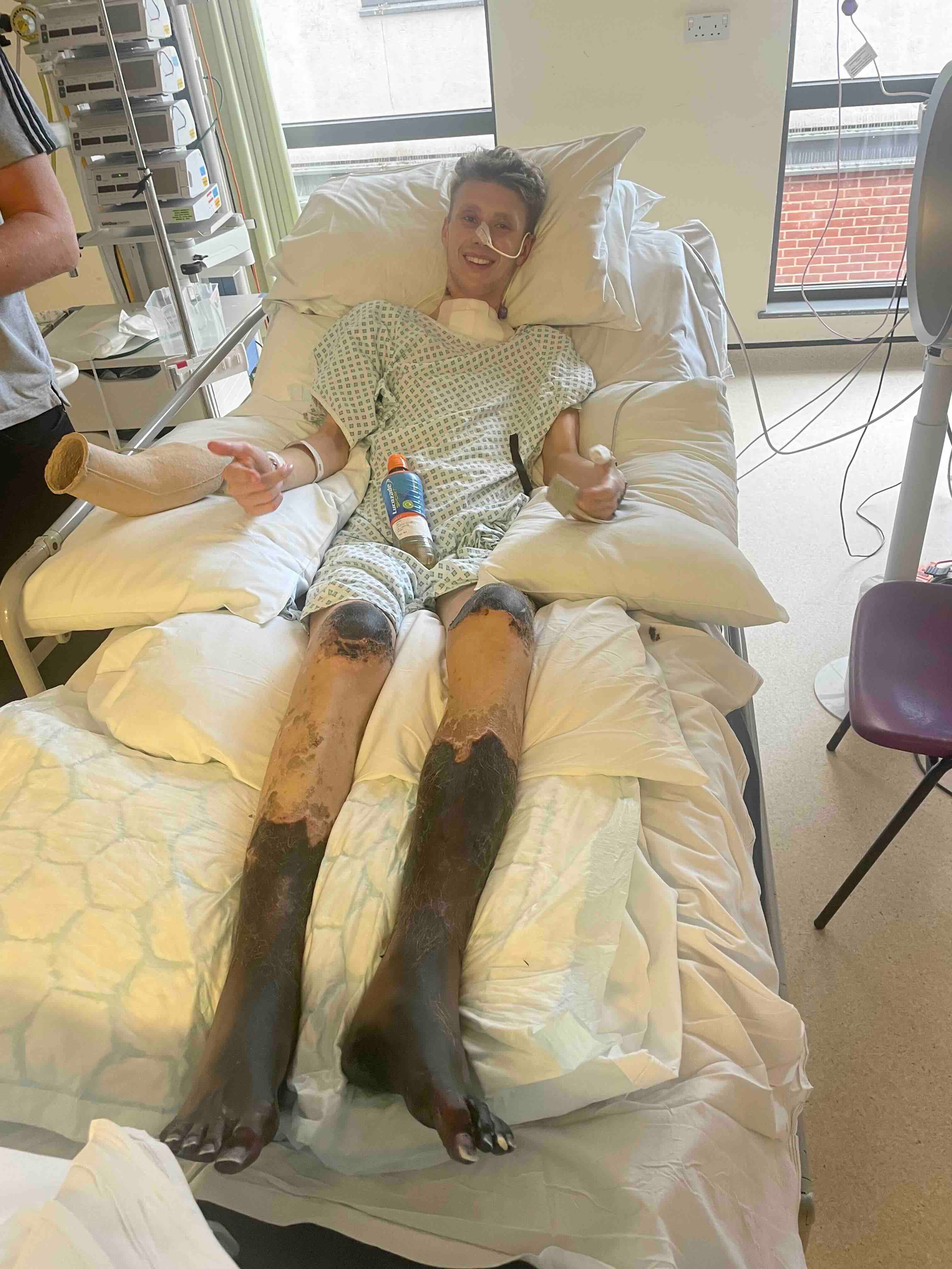 Footballer who went to hospital with flu symptoms has legs amputated after sepsis The Independent pic