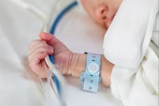 What is Kawasaki disease? Symptoms, treatments and when to seek help