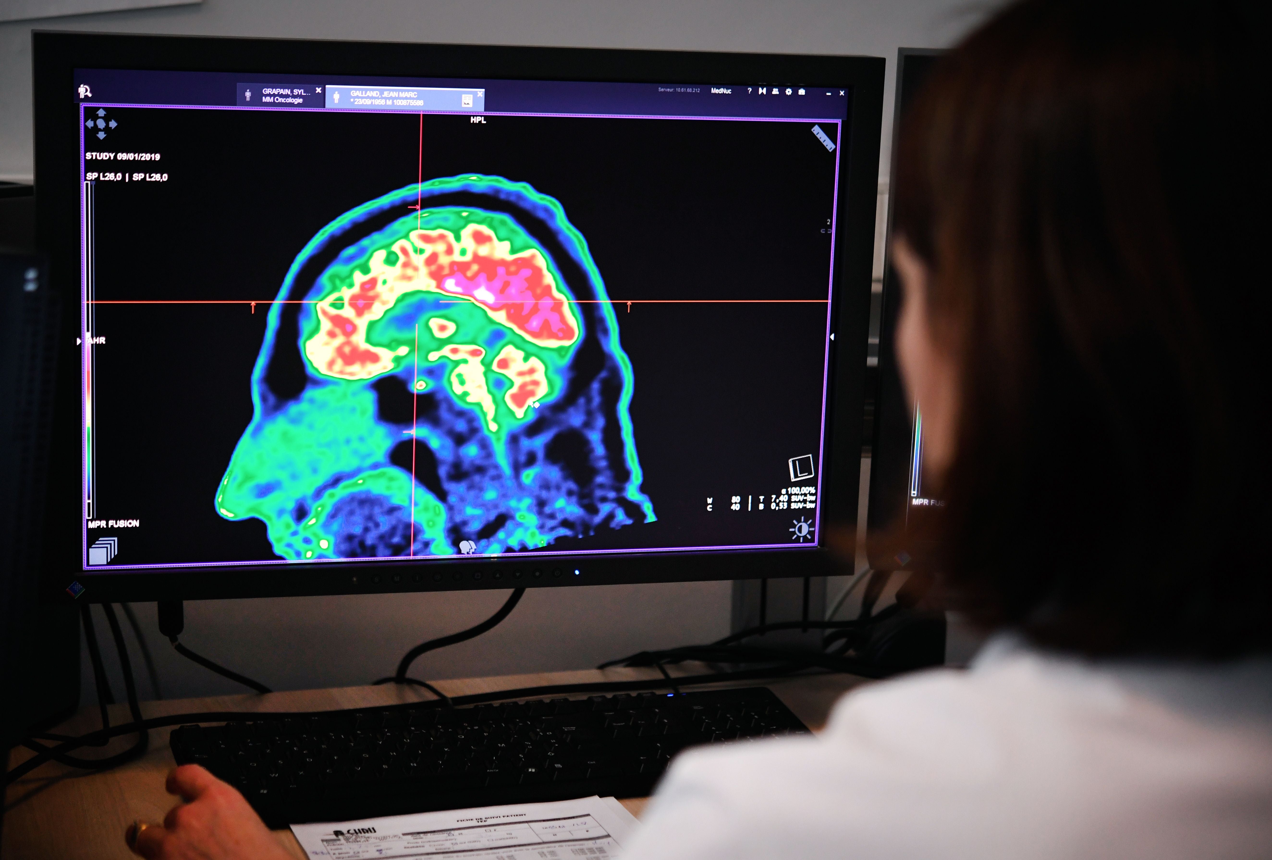 The study examined more than 7,800 MRI scans from men and women across 29 countries