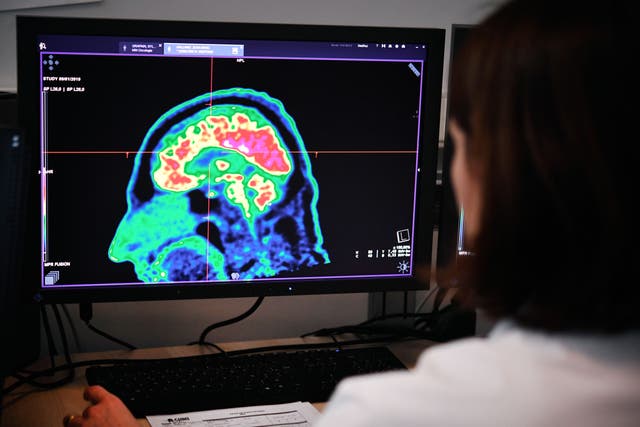 <p>The study examined more than 7,800 MRI scans from men and women across 29 countries</p>