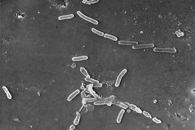 <p>An electron microscope scan showing rod-shaped Pseudomonas aeruginosa bacteria</p>