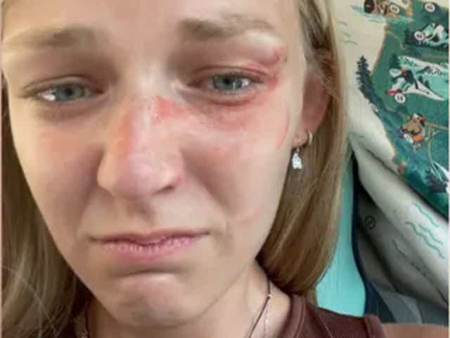 Una foto de Gabby Petito que muestra sangre y moretones en su rostro justo antes de que ella y su ex prometido Brian Laundrie fueran detenidos por agentes de policía de Moab que investigaban una llamada de abuso doméstico.