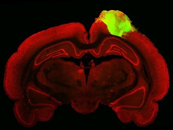 <p>A rat brain with a transplanted human cortical organoid (green)</p>