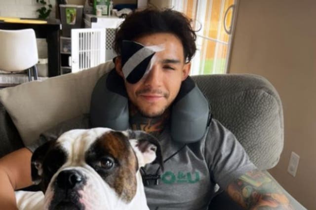 <p>UFC featherweight Andre Fili after undergoing eye surgery</p>