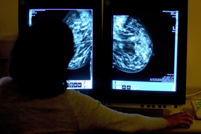 A medic studies a mammogram of a woman’s breast, as women are urged to take up screening appointments (Rui Vieira/PA)