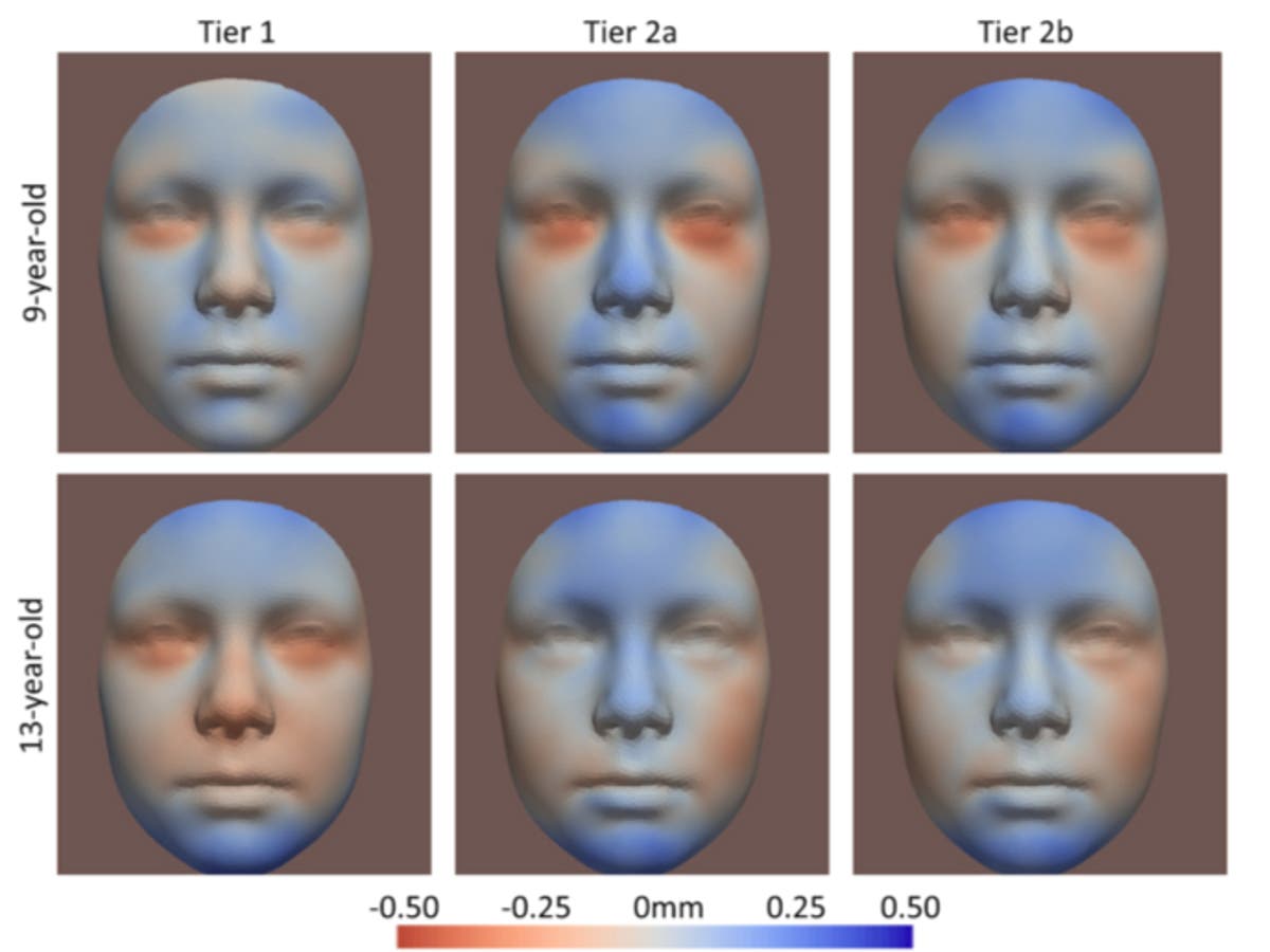 Drinking alcohol in months before pregnancy &lsquo;changes baby&rsquo;s face&rsquo;