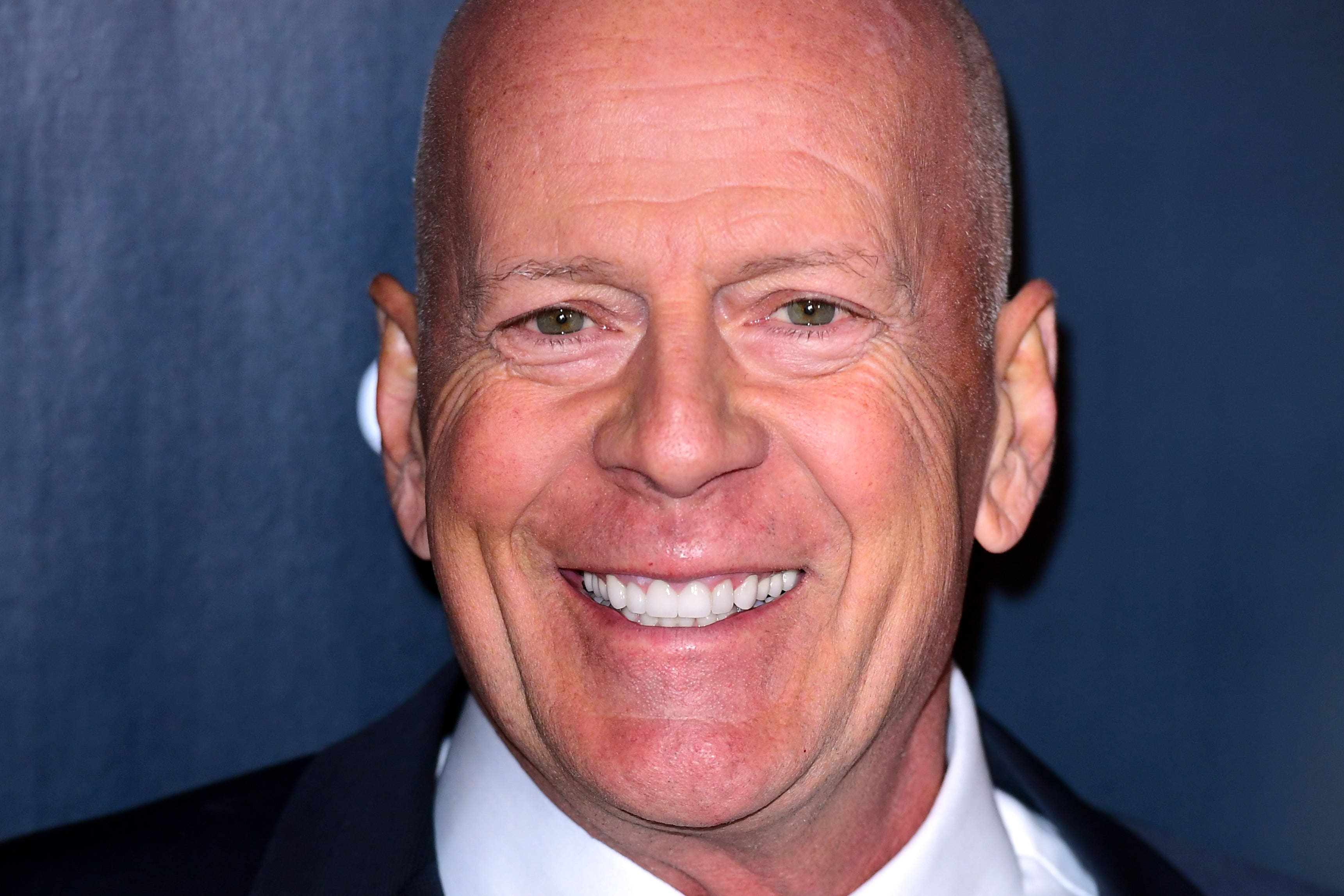 7 stages of frontotemporal dementia Bruce Willis’s condition explained