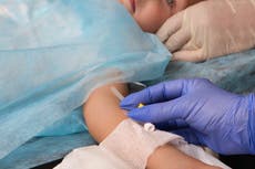 Children’s surgery backlog grows as NHS prioritises adult waiting lists