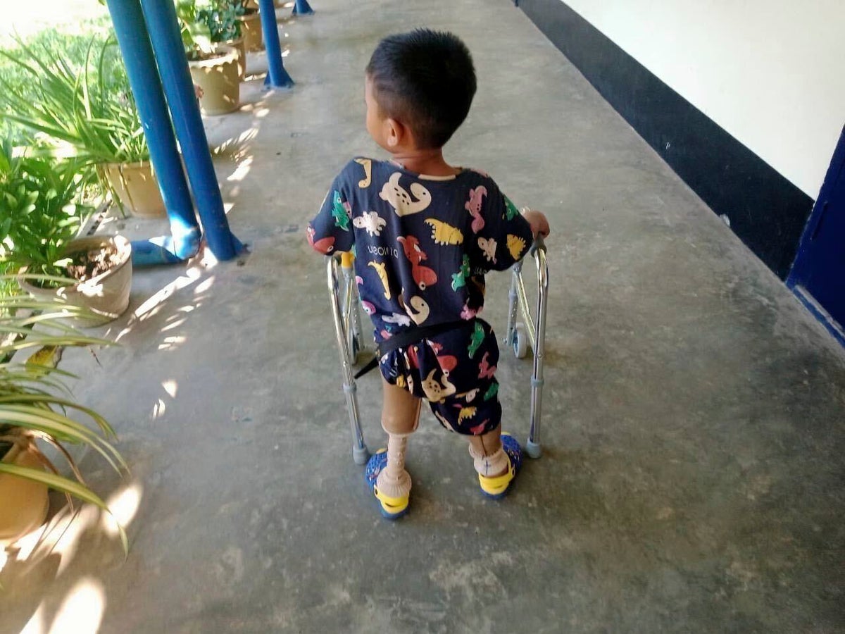 ‘I just want my legs back’: Myanmar landmine casualties soar