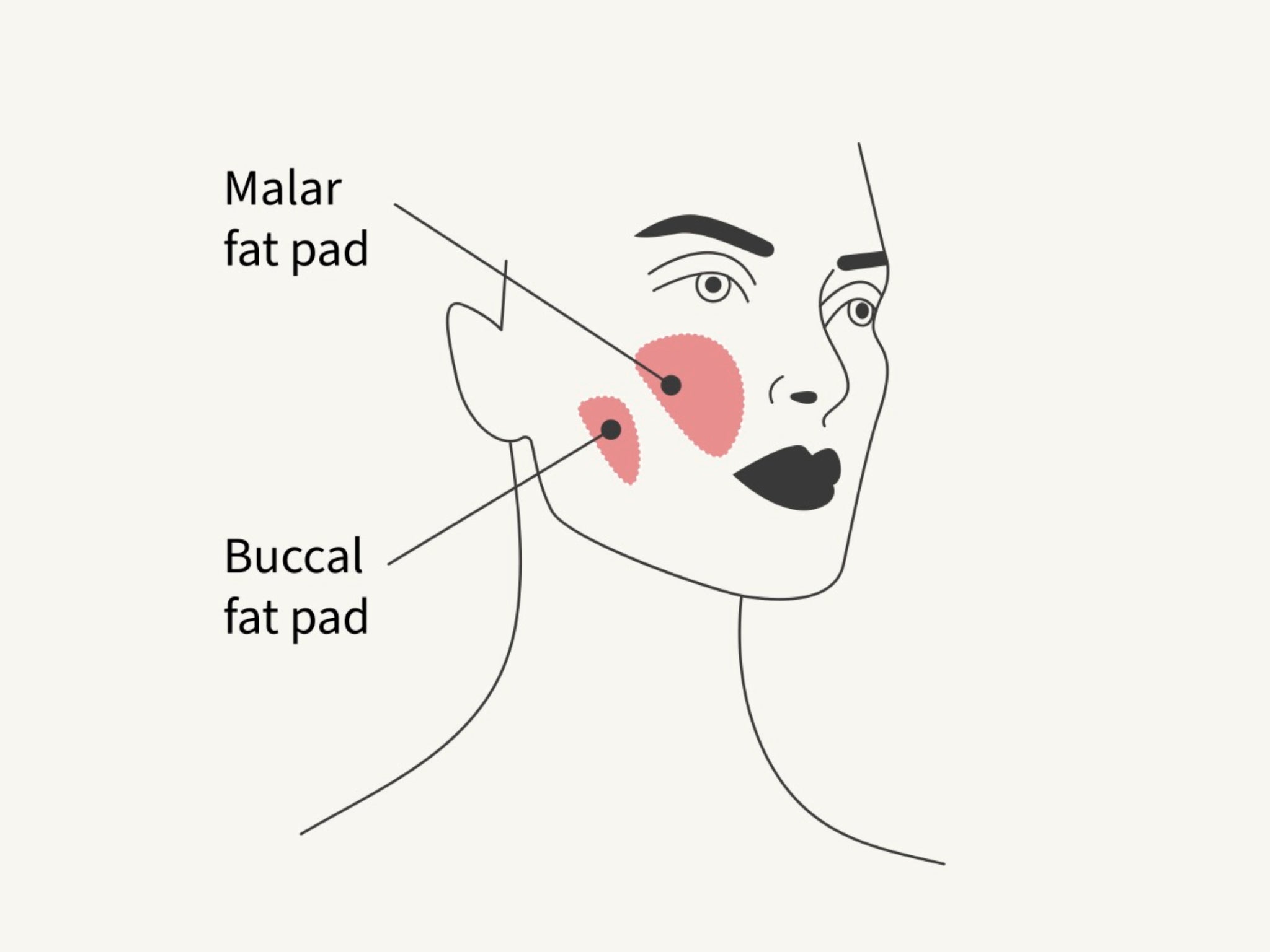 ‘Buccal fat removal doesn’t create definition, it just creates emptiness between the cheek and the jawline,’ said Dr Tiryaki