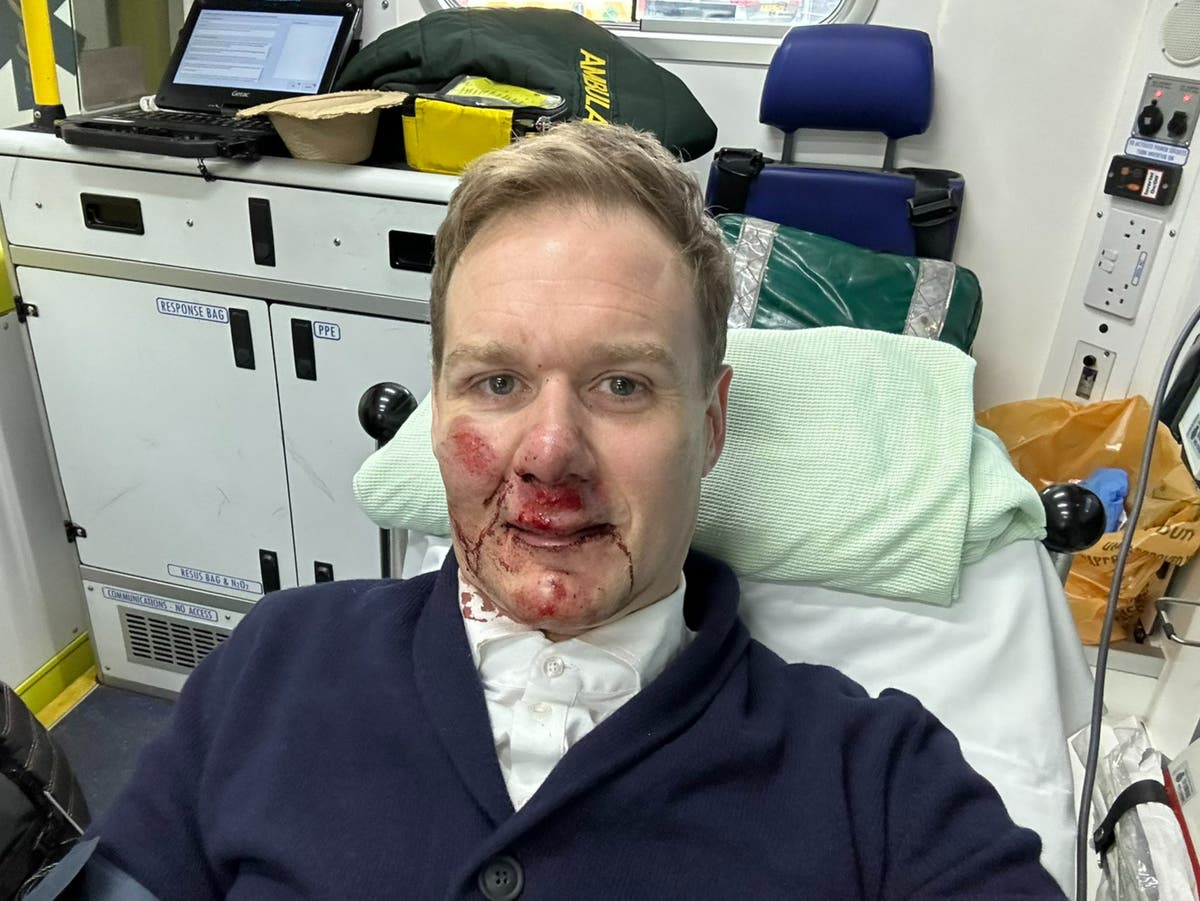 Dan Walker ‘glad to be alive’ after being hit by a car while cycling