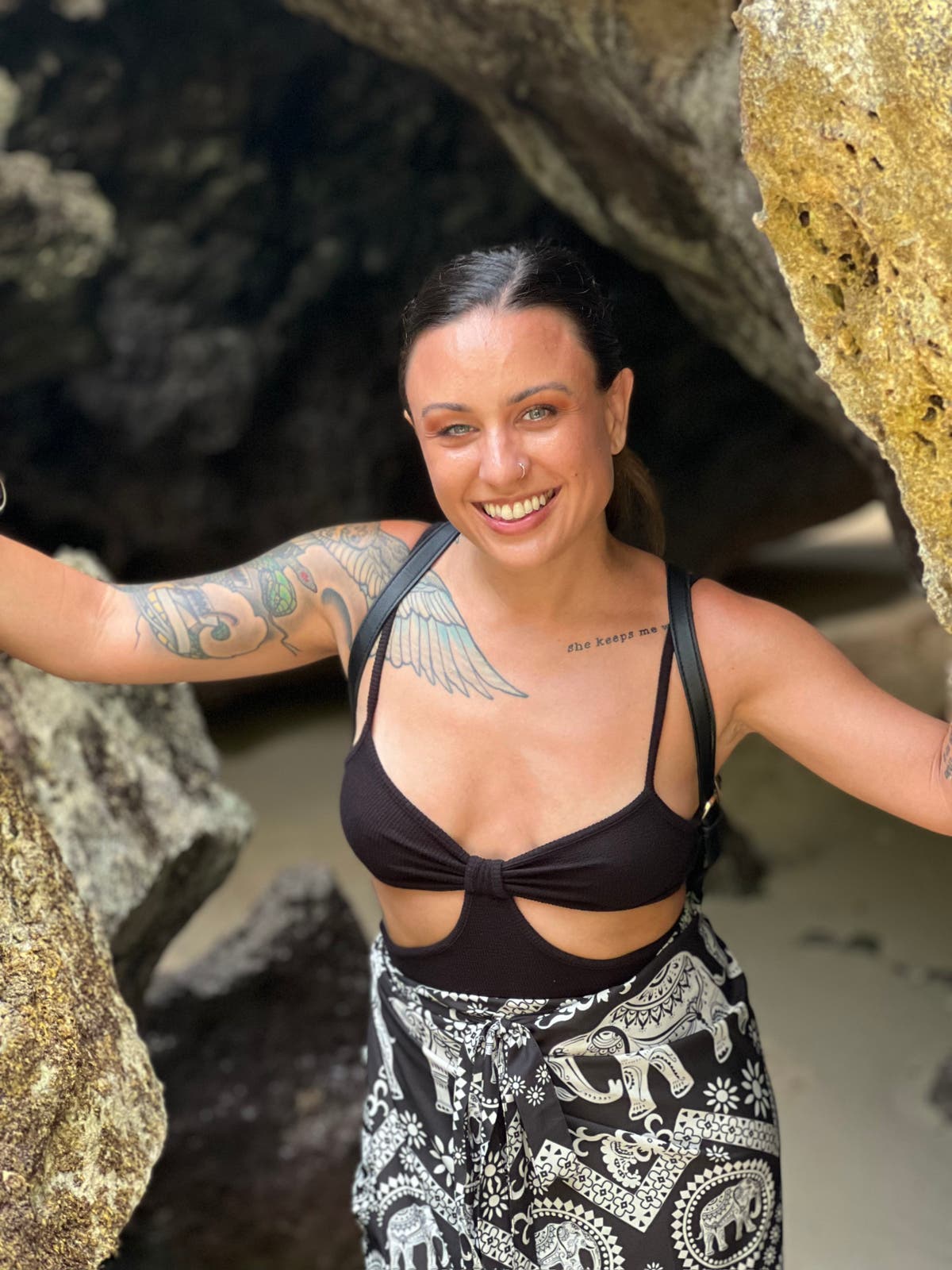 Woman with rare jaw-winking syndrome &lsquo;became an emo&rsquo; to hide condition